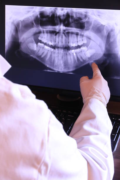 Best Emergency Dental Care for Broken or Chipped Teeth in Warrior, AL